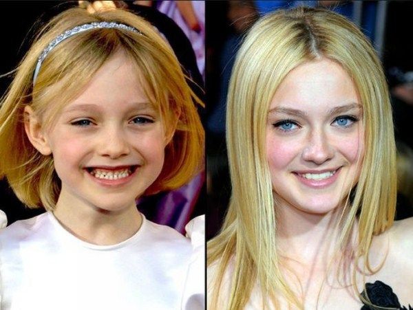  photo then_and_now_celebrities_01_zps484225f6.jpg
