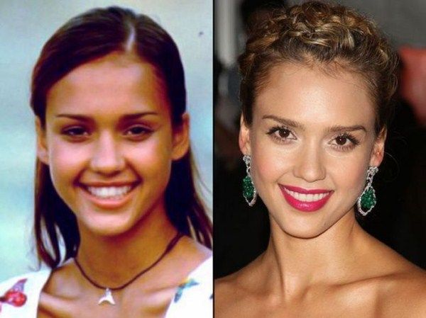  photo then_and_now_celebrities_20_zps5f01198e.jpg